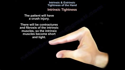 extrinsic tightness hand test